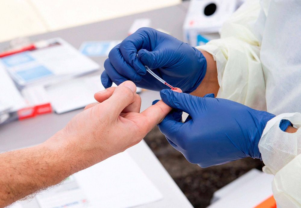 Covid-19 disease Antibody test